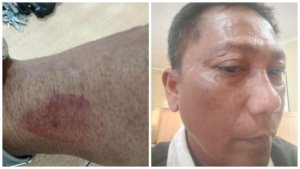 DPD PJS Sumut Desak Polisi Tangkap Pelaku Penganiayaan Wartawan di Toba