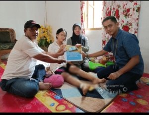 Bantuan PT TIMAH Ringankan Biaya Pengobatan Anak Nurhasanah